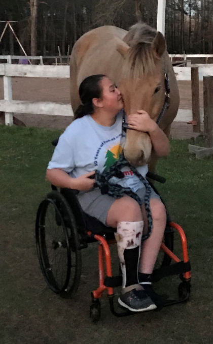 Analiese, a young woman with a prosthetic leg, hugs and kisses a light brown horse while holding its bridle outdoors near a white fence on a grassy area. Their bond tells a touching story of connection and resilience.